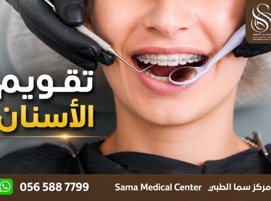 مركز تقويم اسنان في الشارقة