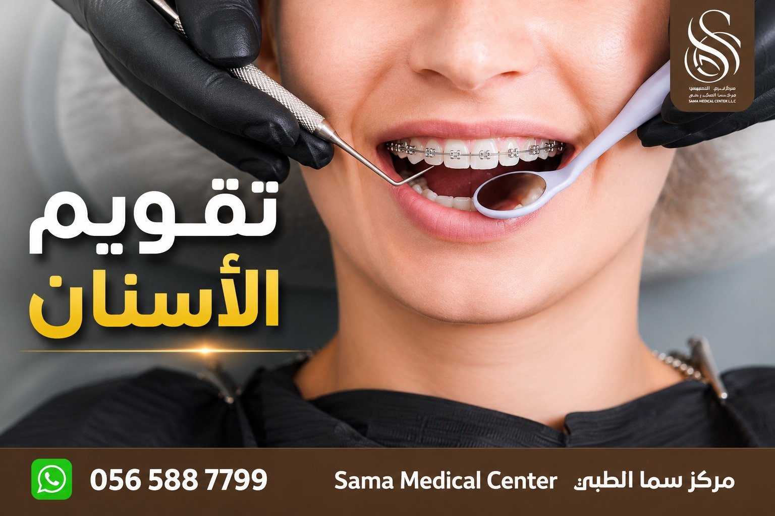 مركز تقويم اسنان في الشارقة