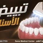 تبييض اسنان في الشارقة