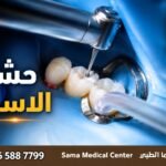 حشو اسنان في الشارقة