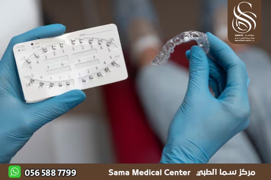 مركز تقويم اسنان شفاف في الشارقة