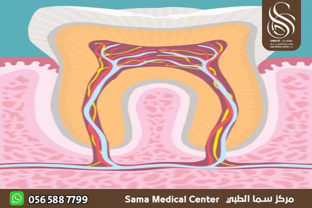 علاج عصب الاسنان في الشارقة
