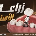 زراعة أسنان في الشارقة