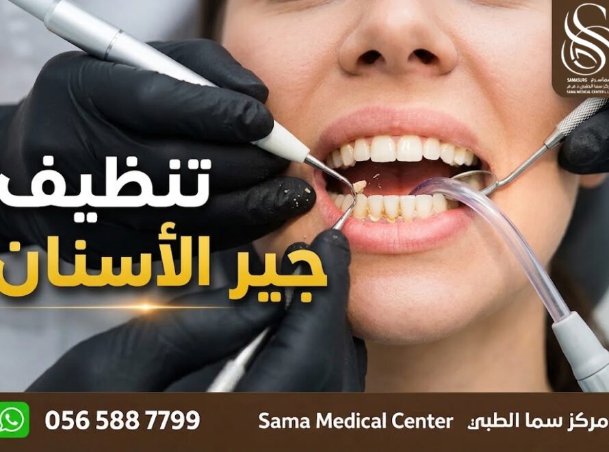 تنظيف الأسنان وإزالة الجير في الشارقة