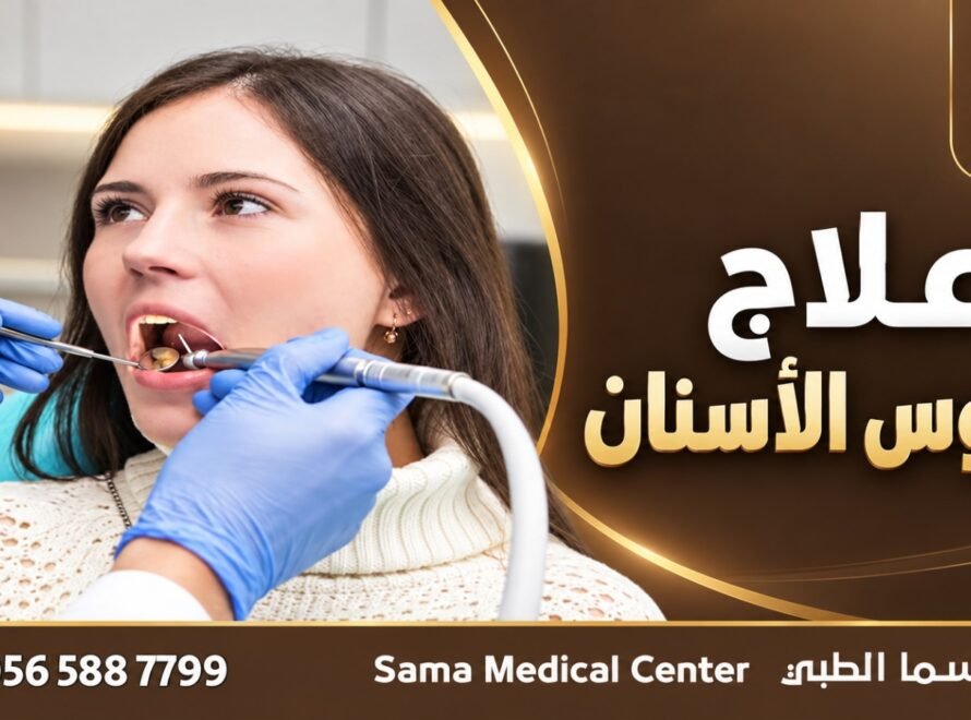 علاج تسوس الأسنان في الشارقة