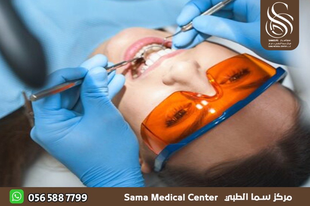 تجميل اسنان في الشارقة