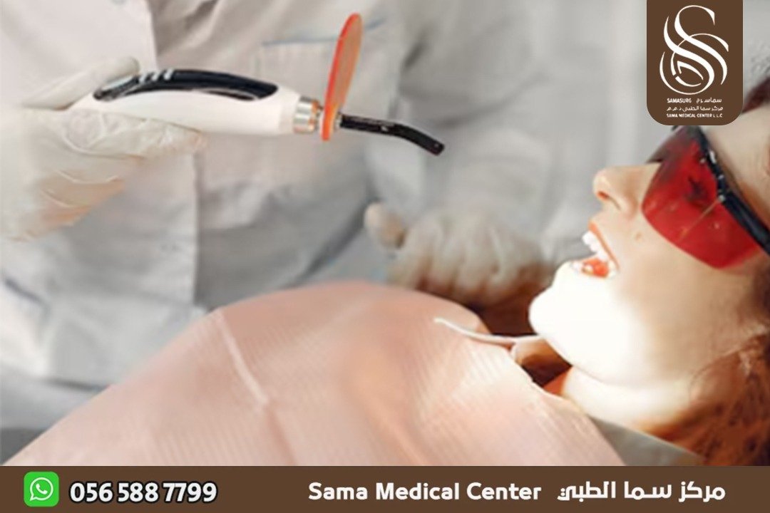 تجميل اسنان في الشارقة