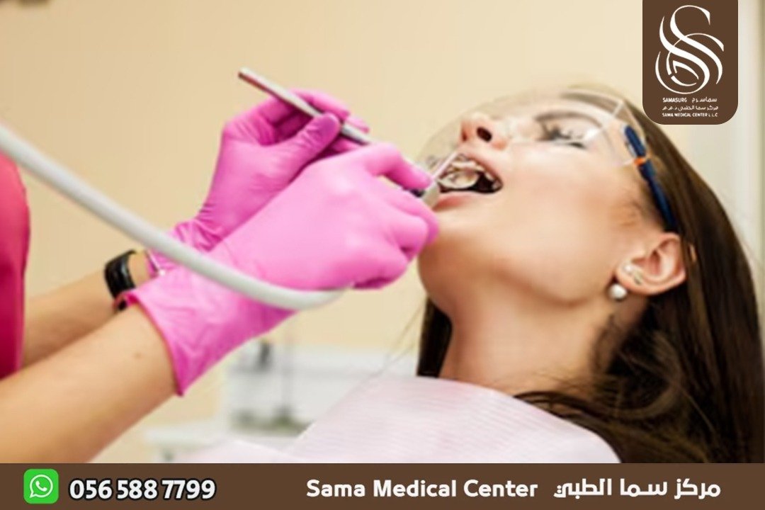 تجميل اسنان في الشارقة