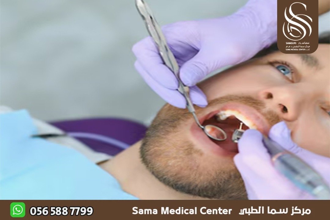 علاج تسوس الأسنان في الشارقة