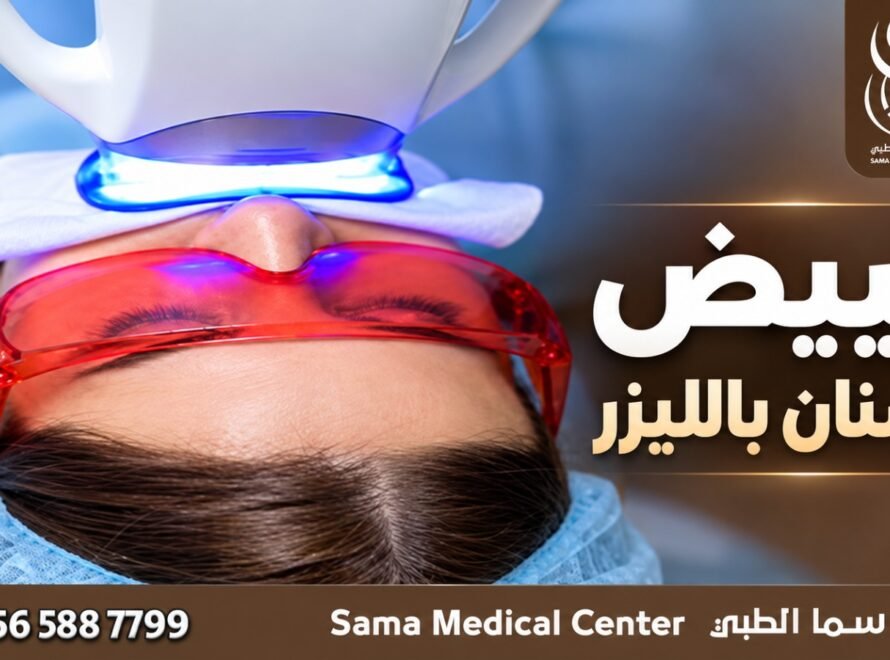 تبييض الاسنان بالليزر في الشارقة