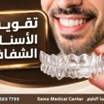 تقويم الأسنان الشفاف في الشارقة