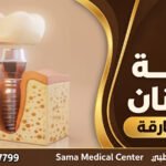 زراعة الأسنان في الشارقة