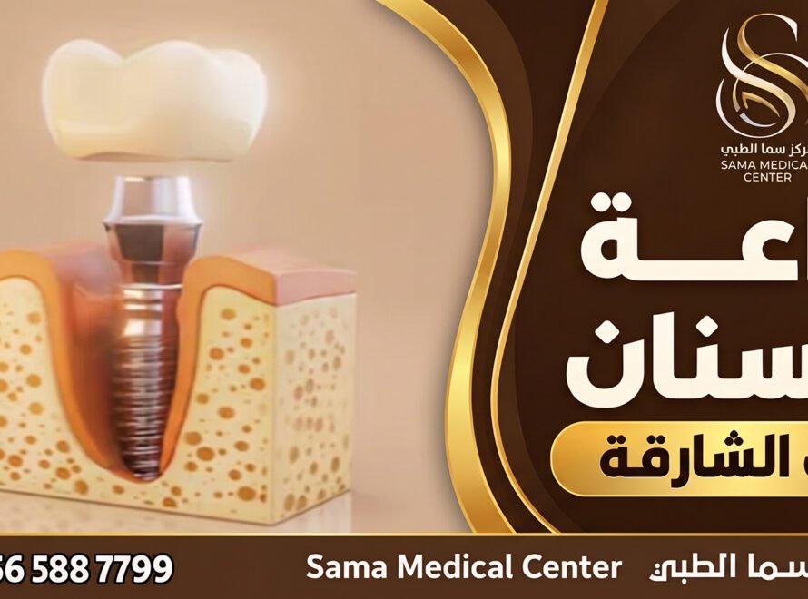 زراعة الأسنان في الشارقة