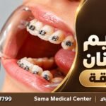 تقويم الأسنان في الشارقة