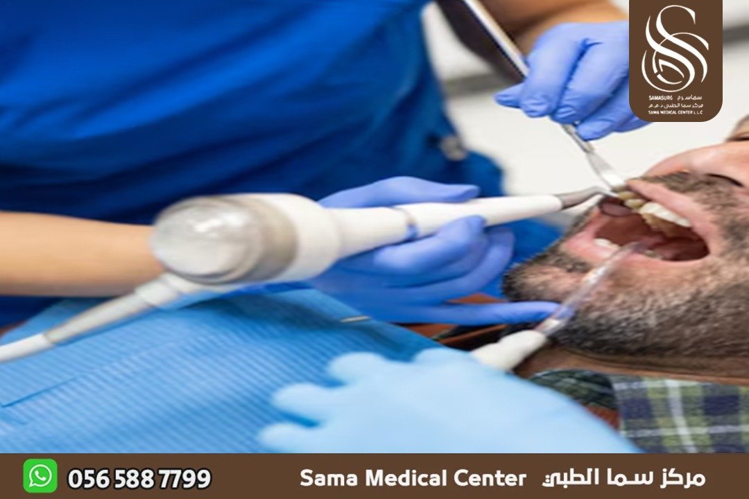 تنظيف الأسنان في الشارقة